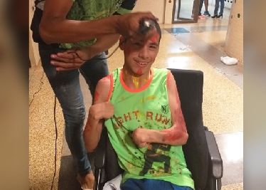 notícia: Estudante com deficiência intelectual é aprovado em universidade federal