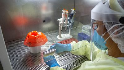 notícia: Governo orienta que unidades de saúde façam testes RT-PCR para detectar casos de síndrome gripal 