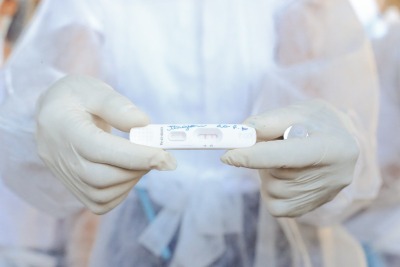 notícia: Covid-19: Amapá registra aumento de casos, mas internações e óbitos permanecem controlados