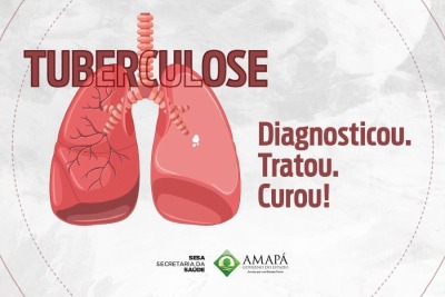 notícia: Estado alerta para aumento de 41% nos casos de tuberculose