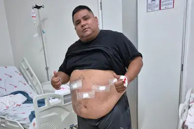 notícia: 'Antes, eu só sobrevivia. Agora, vou viver', garante paciente após cirurgia bariátrica pelo Barisus do Governo do Amapá