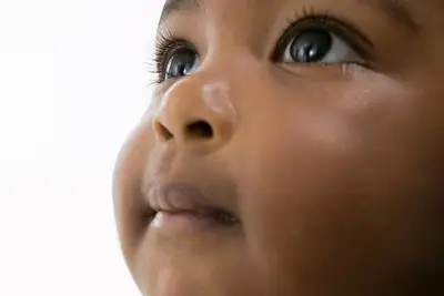 notícia: Amapá adere pela primeira vez à campanha nacional 'De Olho nos Olhinhos' para conscientização sobre câncer ocular