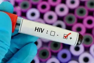 notícia: Governo do Amapá intensifica ações de prevenção e cuidado no enfrentamento ao HIV/Aids