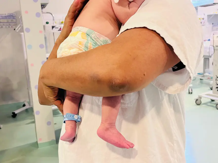 O leite humano doado é utilizado principalmente para atender recém-nascidos internados que apresentam maior vulnerabilidade