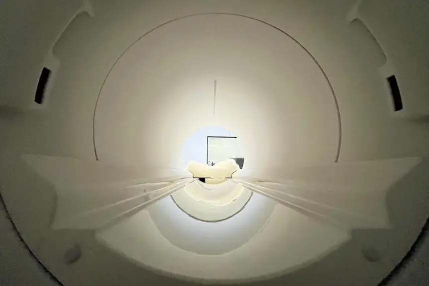Detalhe do tomógrafo, tecnologia essencial para investigar traumas graves, AVC e tumores